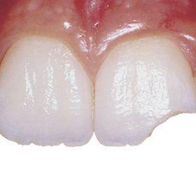 Clinica-Dental-Pallach-Tu-Dentista-en-Corbera-Llobregat-936505425